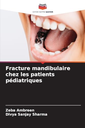 Fracture mandibulaire chez les patients pédiatriques: DE von Editions Notre Savoir