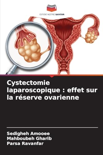 Cystectomie laparoscopique : effet sur la réserve ovarienne von Editions Notre Savoir