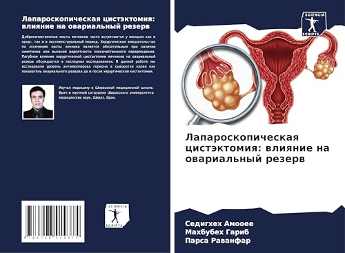 Laparoskopicheskaq cistäktomiq: wliqnie na owarial'nyj rezerw von Sciencia Scripts