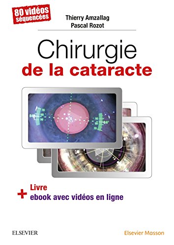 Chirurgie De La Cataracte: 60 Videos Sequencees Chirurgie De La Cataracte: 60 Videos Sequencees von Elsevier Masson