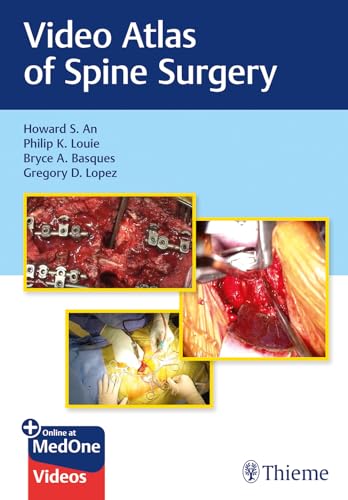 Video Atlas of Spine Surgery: Mit E-Book