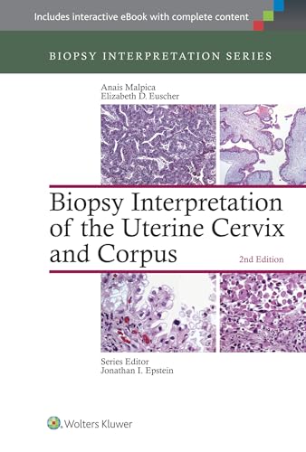 Biopsy Interpretation of the Uterine Cervix and Corpus von LWW