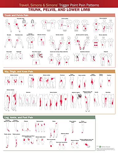 Travell, Simons & Simons Trigger Point Pain Patterns Wall Chart: Trunk, Pelvis, and Lower Limb