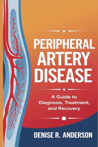 Peripheral Artery Disease: A Guide to Diagnosis, ofTreatment, and Recovery von Independently published