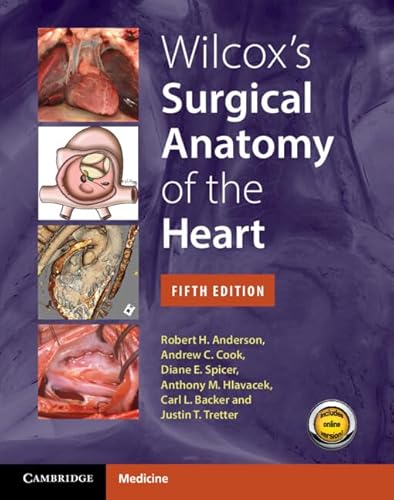 Wilcox's Surgical Anatomy of the Heart von Cambridge University Press