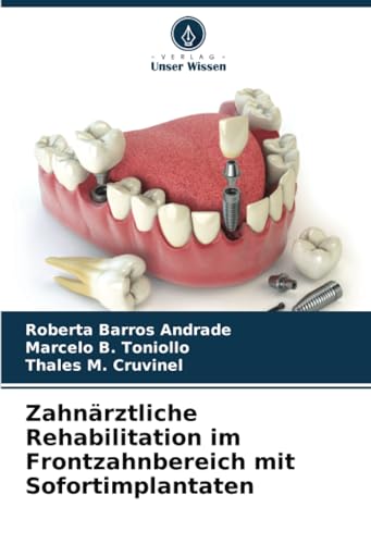 Zahnärztliche Rehabilitation im Frontzahnbereich mit Sofortimplantaten: DE von Verlag Unser Wissen