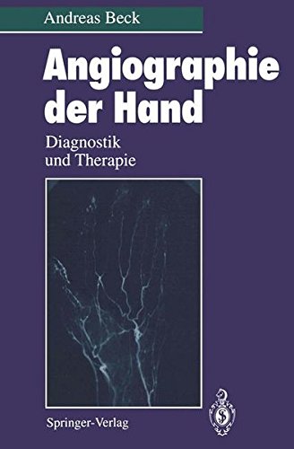 Angiographie der Hand: Diagnostik und Therapie von Springer