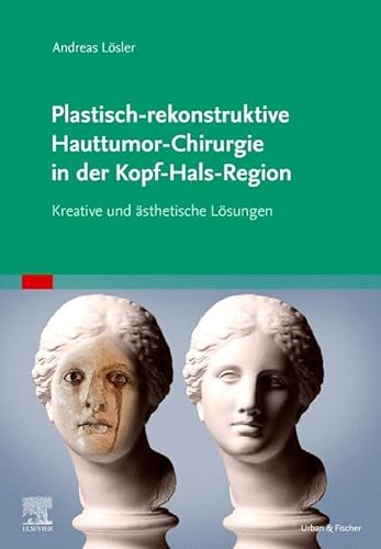 Plastisch-rekonstruktive Hauttumor-Chirurgie in der Kopf-Hals-Region: Kreative individuelle und ästhetische Lösungen von Elsevier