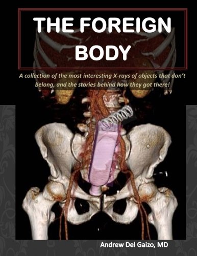 The Foreign Body: A collection of the most interesting X-rays of things that don't belong and the stories behind how they got there! von CreateSpace Independent Publishing Platform