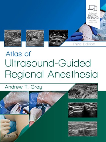 Atlas of Ultrasound-Guided Regional Anesthesia: Expert Consult - Online and Print