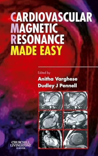 Cardiovascular Magnetic Resonance Made Easy von Churchill Livingstone