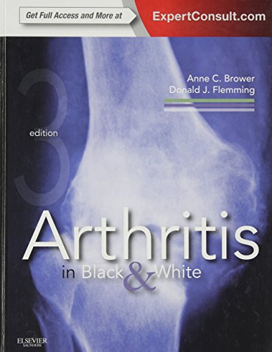 Arthritis in Black and White: Expert Consult - Online and Print