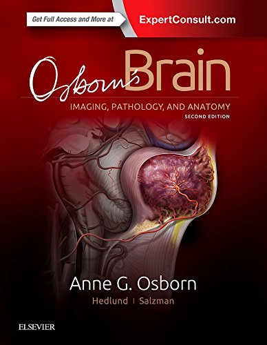 Osborn's Brain: Imaging, Pathology and Anatomy. ExpertConsult.com von Elsevier