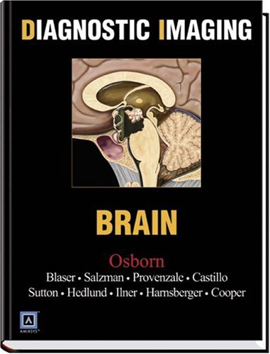 Diagnostic Imaging: Brain: Top 250 Diagnostic Diagnostic Imaging: Brain: Top 250 Diagnostic von Elsevier Ltd, Oxford