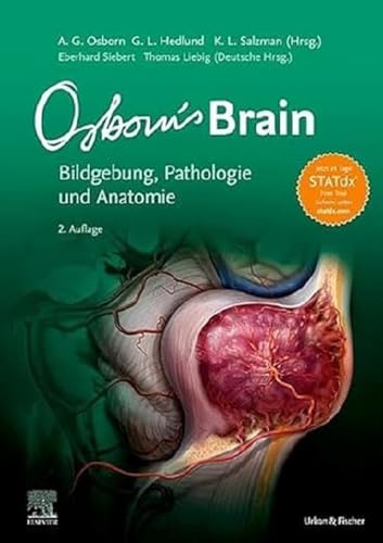 Osborn's Brain: Bildgebung, Pathologie und Anatomie