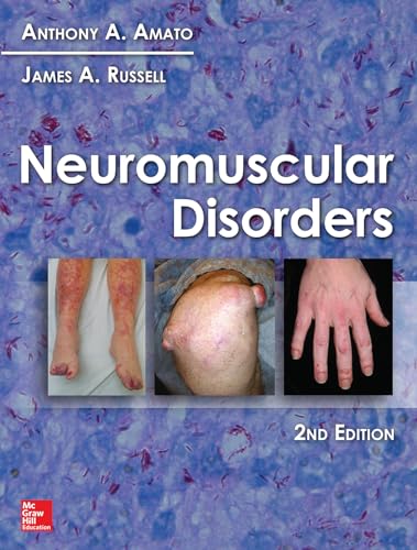 Neuromuscular Disorders Neuromuscular Disorders
