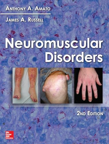 Neuromuscular Disorders