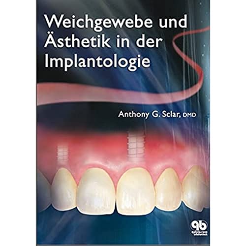 Weichgewebe und Ästhetik in der Implantologie von Quintessenz Verlag
