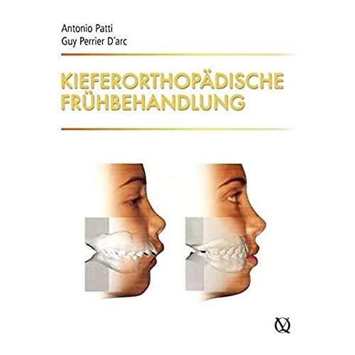 Kieferorthopädische Frühbehandlung von Quintessenz Verlag