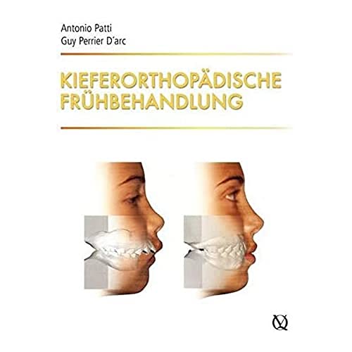 Kieferorthopädische Frühbehandlung