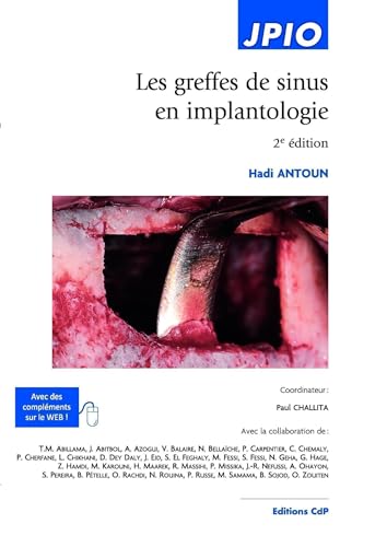 Les greffes de sinus en implantologie: 2E EDITION