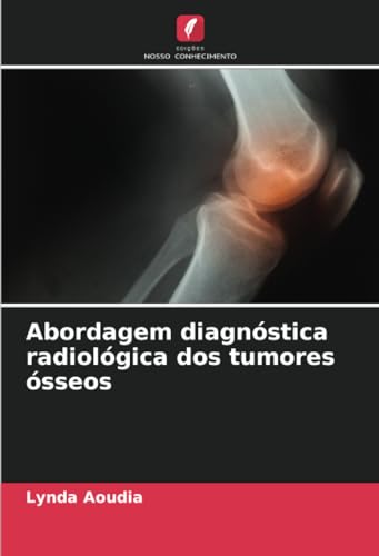 Abordagem diagnóstica radiológica dos tumores ósseos: DE von Edições Nosso Conhecimento