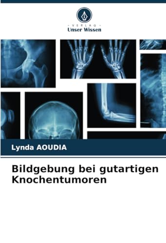 Bildgebung bei gutartigen Knochentumoren: DE von Verlag Unser Wissen