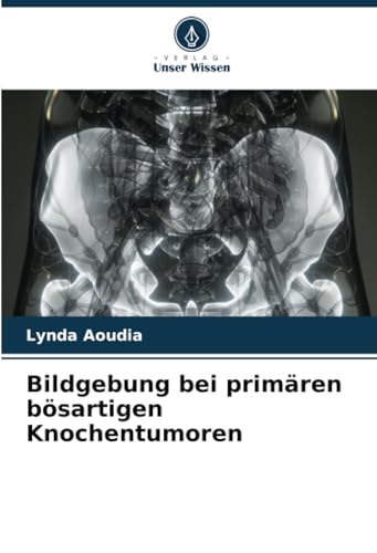 Bildgebung bei primären bösartigen Knochentumoren: DE von Verlag Unser Wissen