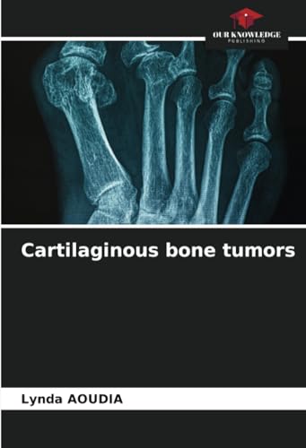 Cartilaginous bone tumors von Our Knowledge Publishing