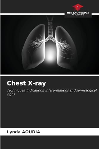 Chest X-ray: Techniques, indications, interpretations and semiological signs von Our Knowledge Publishing
