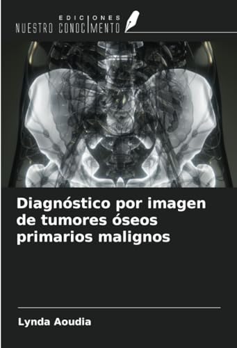 Diagnóstico por imagen de tumores óseos primarios malignos von Ediciones Nuestro Conocimiento