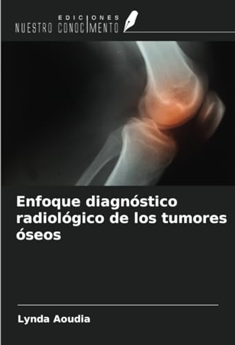 Enfoque diagnóstico radiológico de los tumores óseos von Ediciones Nuestro Conocimiento