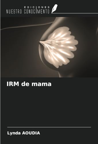 IRM de mama von Ediciones Nuestro Conocimiento