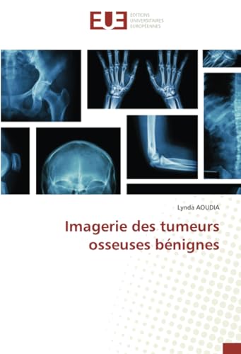 Imagerie des tumeurs osseuses bénignes von Éditions universitaires européennes