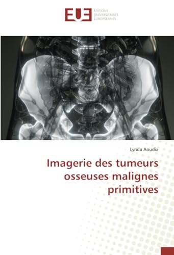 Imagerie des tumeurs osseuses malignes primitives von Éditions universitaires européennes