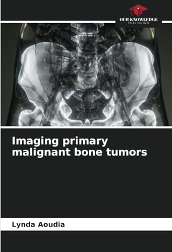 Imaging primary malignant bone tumors: DE von Our Knowledge Publishing
