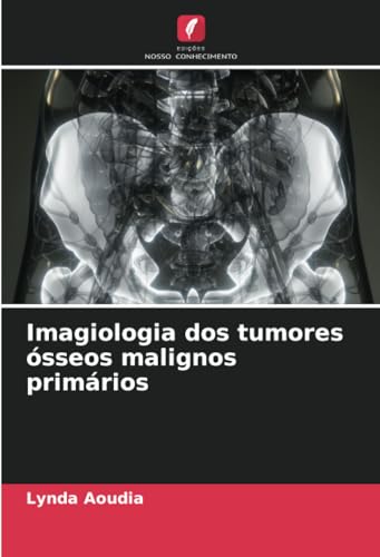 Imagiologia dos tumores ósseos malignos primários: DE von Edições Nosso Conhecimento