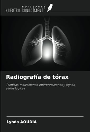 Radiografía de tórax: Técnicas, indicaciones, interpretaciones y signos semiológicos von Ediciones Nuestro Conocimiento