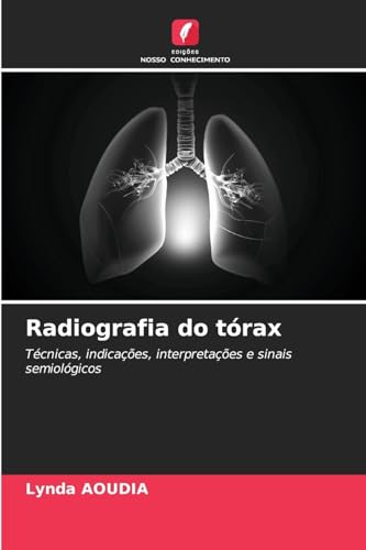 Radiografia do tórax: Técnicas, indicações, interpretações e sinais semiológicos von Edições Nosso Conhecimento