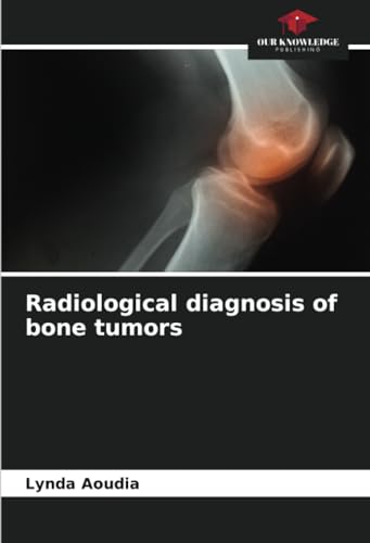 Radiological diagnosis of bone tumors von Our Knowledge Publishing