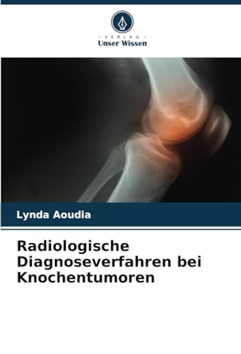 Radiologische Diagnoseverfahren bei Knochentumoren von Verlag Unser Wissen