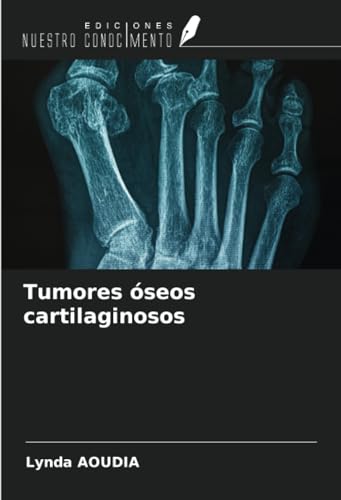 Tumores óseos cartilaginosos von Ediciones Nuestro Conocimiento