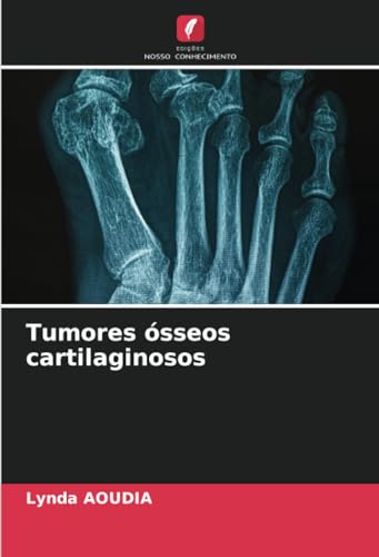 Tumores ósseos cartilaginosos von Edições Nosso Conhecimento