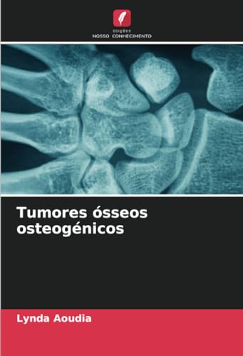 Tumores ósseos osteogénicos: DE von Edições Nosso Conhecimento