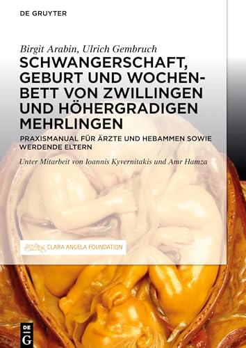 Schwangerschaft, Geburt und Wochenbett von Zwillingen und höhergradigen Mehrlingen: Praxismanual für Ärzte und Hebammen sowie werdende Eltern