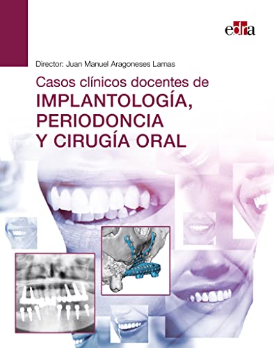 Casos clínicos docentes de implantología, periodoncia y cirugía oral von Edra