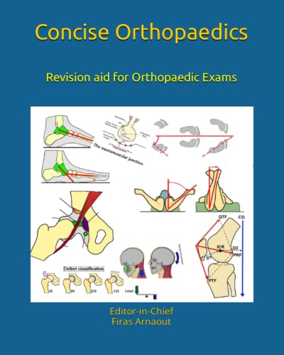 Concise Orthopaedic Notes: Revision aid for FRCS , EBOT , SICOT and Board Examinations (Concise Orthopaedics) Concise Orthopaedic Notes: Revision aid for FRCS , EBOT , SICOT and Board Examinations (Concise Orthopaedics)