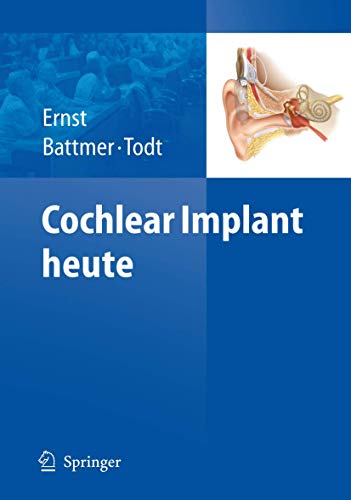 Cochlear Implant heute (German Edition)