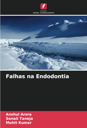 Falhas na Endodontia: DE von Edições Nosso Conhecimento