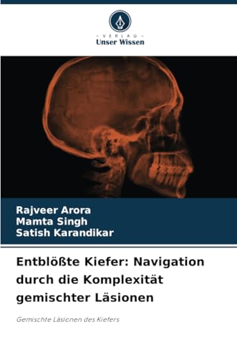 Entblößte Kiefer: Navigation durch die Komplexität gemischter Läsionen: Gemischte Läsionen des Kiefers von Verlag Unser Wissen